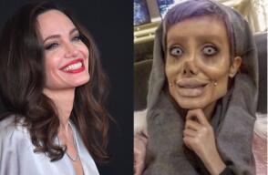 296664_BLU Radio. Mujer Iraní quiso parecerse a Angelina Jolie, pero falló en el intento // Foto: AFP - Instagram