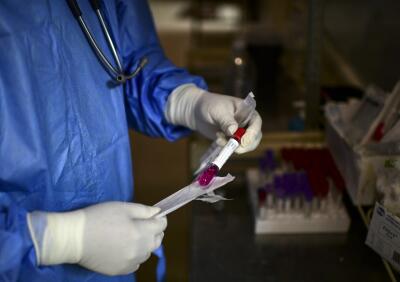 370098_Test coronavirus. Foto: AFP