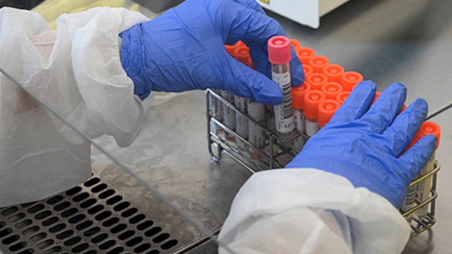 El 80% de las pruebas de coronavirus están llegando con deficiencias al Instituto Nacional de Salud 