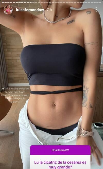 cesarea de Luisa Fernanda W cesarea de Luisa Fernanda W