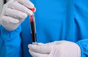 370099_Test COVID-19. Foto: AFP