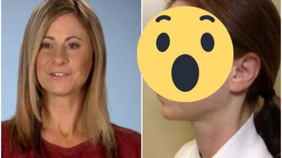 13679_La Kalle. Mujer compró una crema para tratar el cáncer y por poco pierde la nariz / Foto: captura Twitter 13679_La Kalle. Mujer compró una crema para tratar el cáncer y por poco pierde la nariz / Foto: captura Twitter