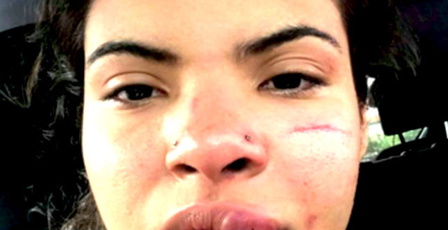 mujer_agredida.jpg