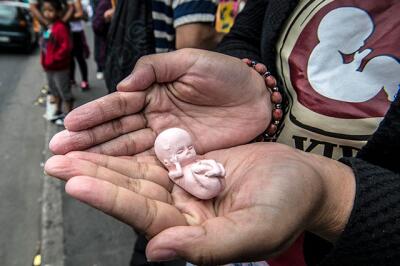 Cuba, país pionero en permitir a las mujeres decisión de abortar o no Cuba, país pionero en permitir a las mujeres decisión de abortar o no