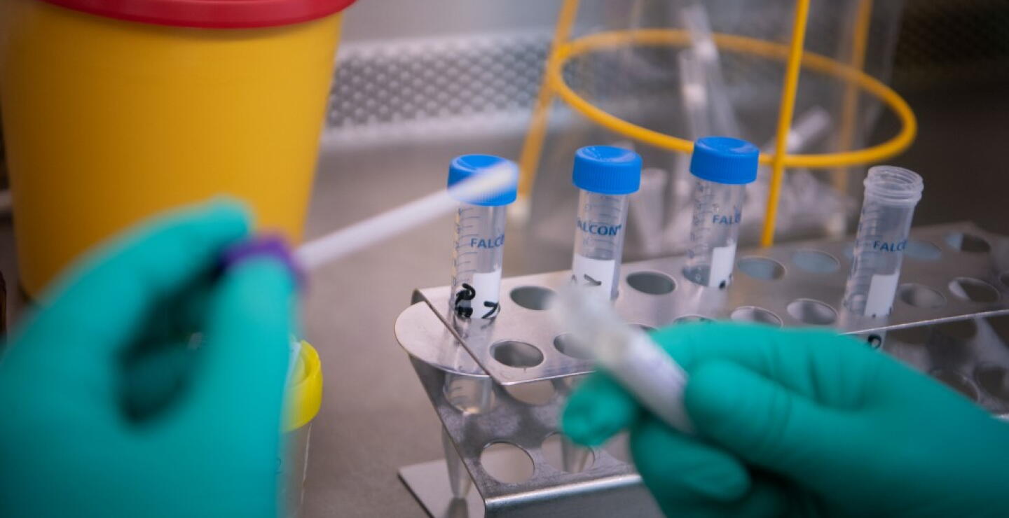 371595_Test coronavirus. Foto: AFP