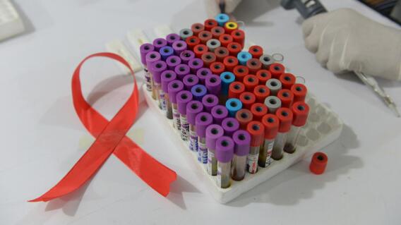 Investigación sobre el VIH.jpeg Investigación sobre el VIH.jpeg