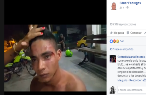 145058_El joven atacado resultó con varias heridas en su rostro. Foto: facebook Eduar Fabras.