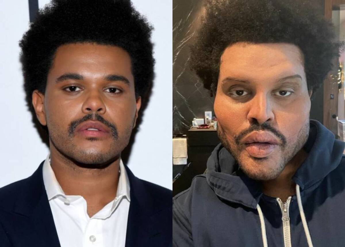 The Weeknd Aparece Con Exceso De Botox Y Cirugias En Nuevo Video Y Los Memes No Lo Perdonan Music video by trap capos, noriel performing antes y después (official video). the weeknd aparece con exceso de botox