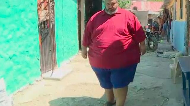 Hombre de 320 kg necesita una operación, pero ninguna camilla soporta su peso