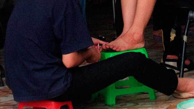 Hongos en las uñas: no los esconda, más bien aprenda a combatirlos