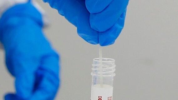 covid_10_coronavirus_coronavirus_covid_2_0.jpeg covid_10_coronavirus_coronavirus_covid_2_0.jpeg