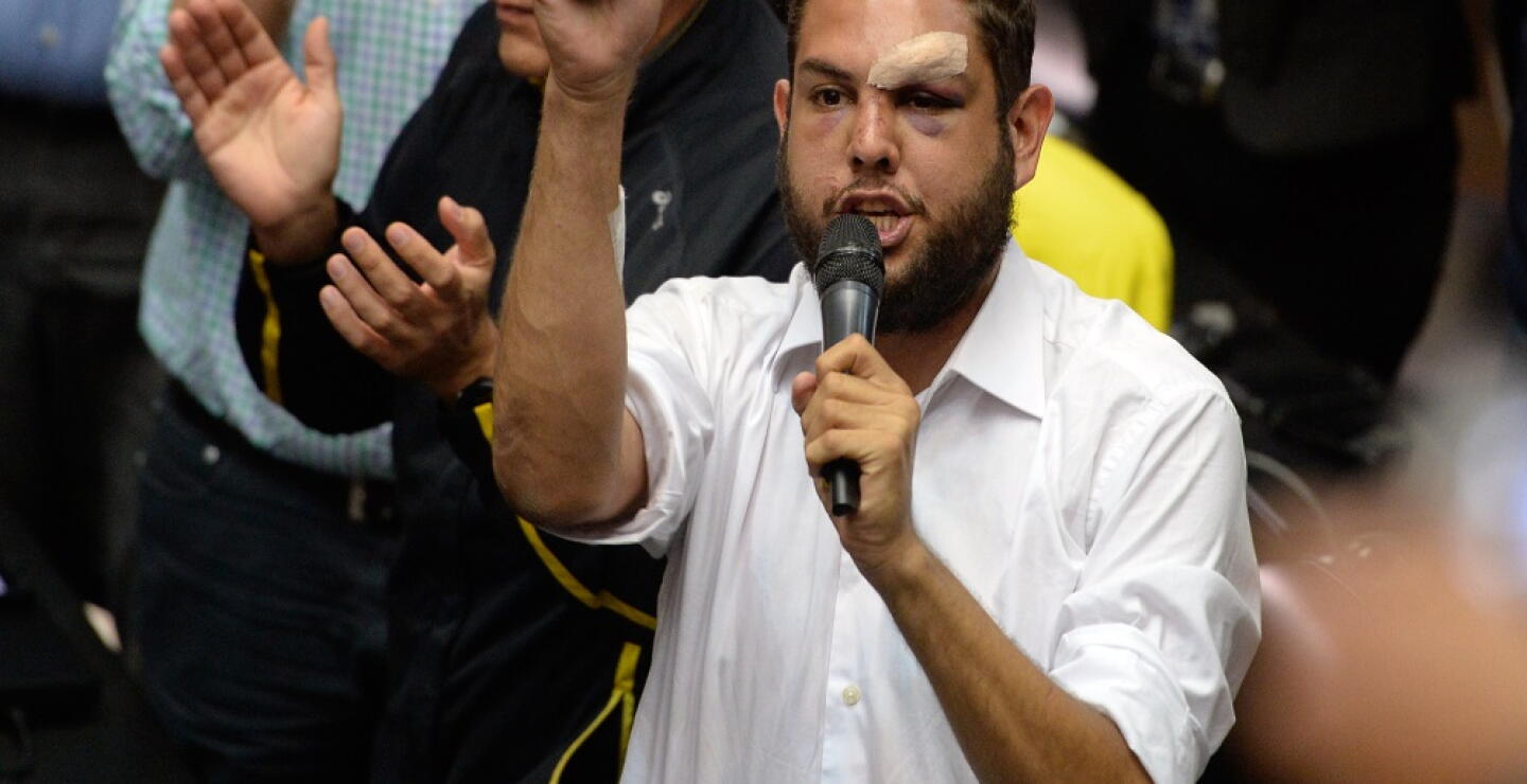 312774_Foto: Juan Requesens /AFP