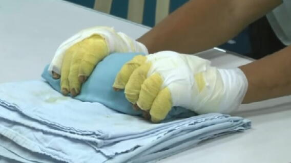 quemado1.jpg