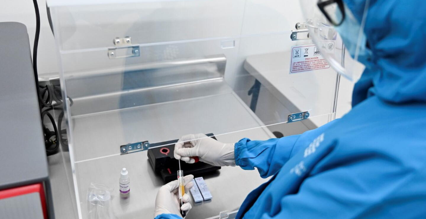 370396_Test coronavirus. Foto: AFP