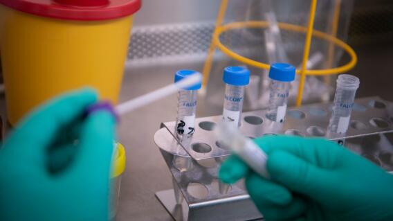 371595_Test coronavirus. Foto: AFP 371595_Test coronavirus. Foto: AFP