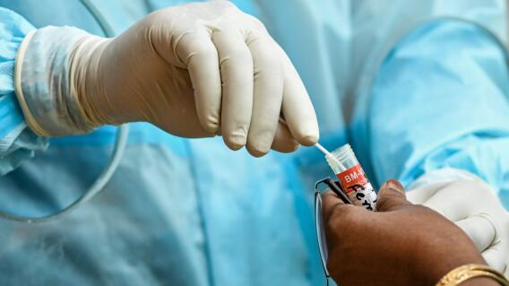 371529_Test coronavirus. Foto: AFP