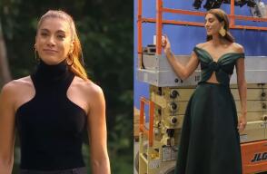 Andrea Serna recordó los accidentes que tuvo cuando niña y le dejaron cicatrices en el cuerpo. Andrea Serna recordó los accidentes que tuvo cuando niña y le dejaron cicatrices en el cuerpo.