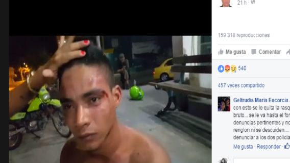 145058_El joven atacado resultó con varias heridas en su rostro. Foto: facebook Eduar Fabras.