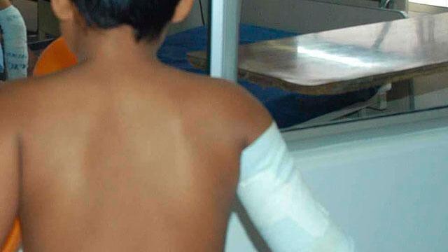 ¿Quién le dio la pólvora? Menor perdió la mano al manipular sustancia usada en armas o explosivos ¿Quién le dio la pólvora? Menor perdió la mano al manipular sustancia usada en armas o explosivos