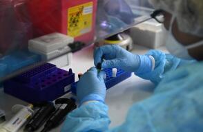 370674_Test coronavirus. Foto: AFP